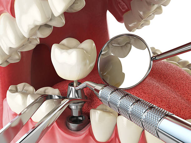 Best Emergency Treatment for Toothache in Mattoon, IL